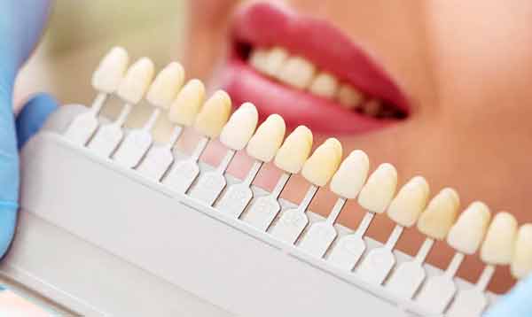 Металлокерамика, керамика или цирконий: что лучше для протезирования